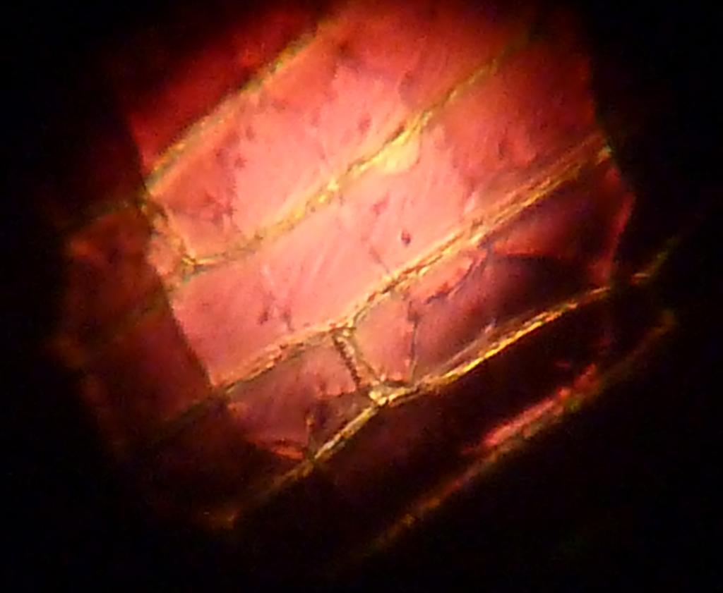Mikroskopbilde av rødløkceller. Foto.