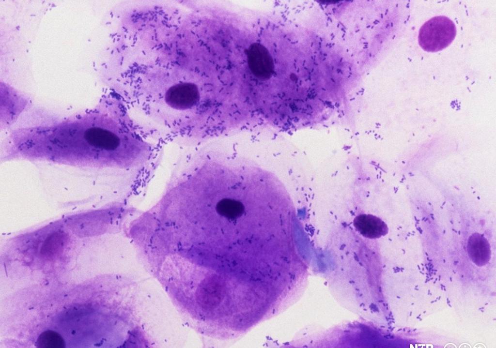 Flere celler med tydelig farget cellekjerne, sammen med bitte små prikker som er bakterier. Mikroskopfoto.