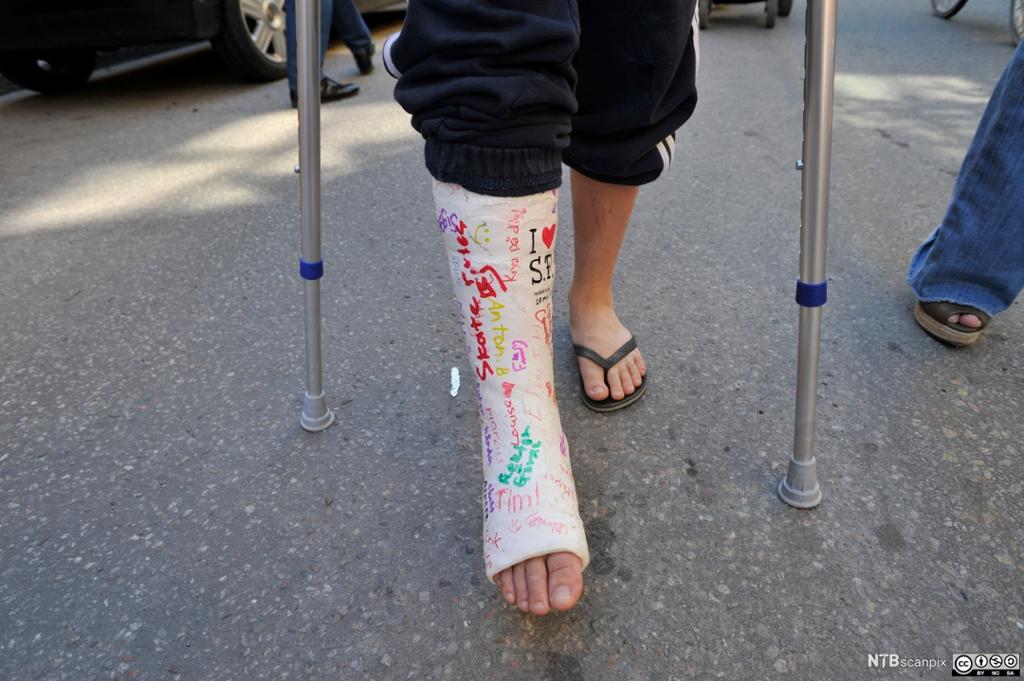 Nærmbilde av en beina til en gutt som har gips på foten og går med krykker. Foto.
