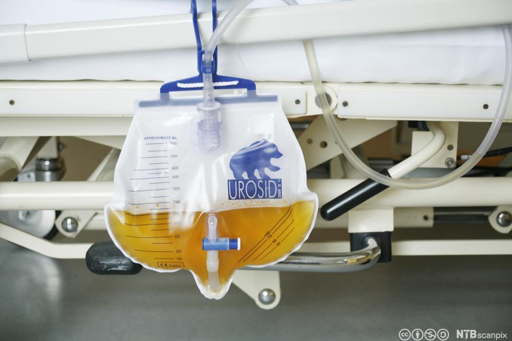 Urinpose med målestreker henger på sykeseng. Foto.