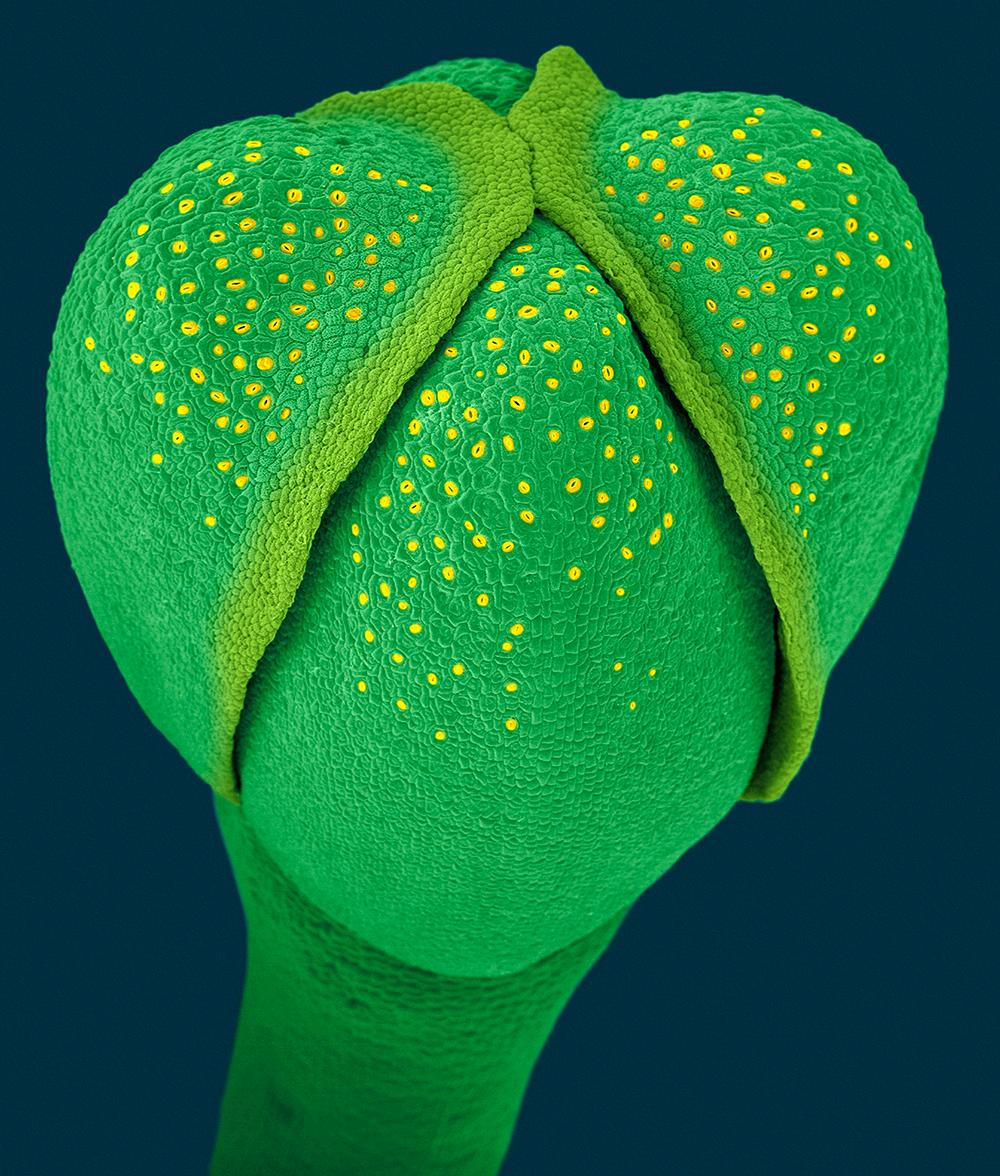 Mikroskopbilde av brokkoliskudd. Foto.