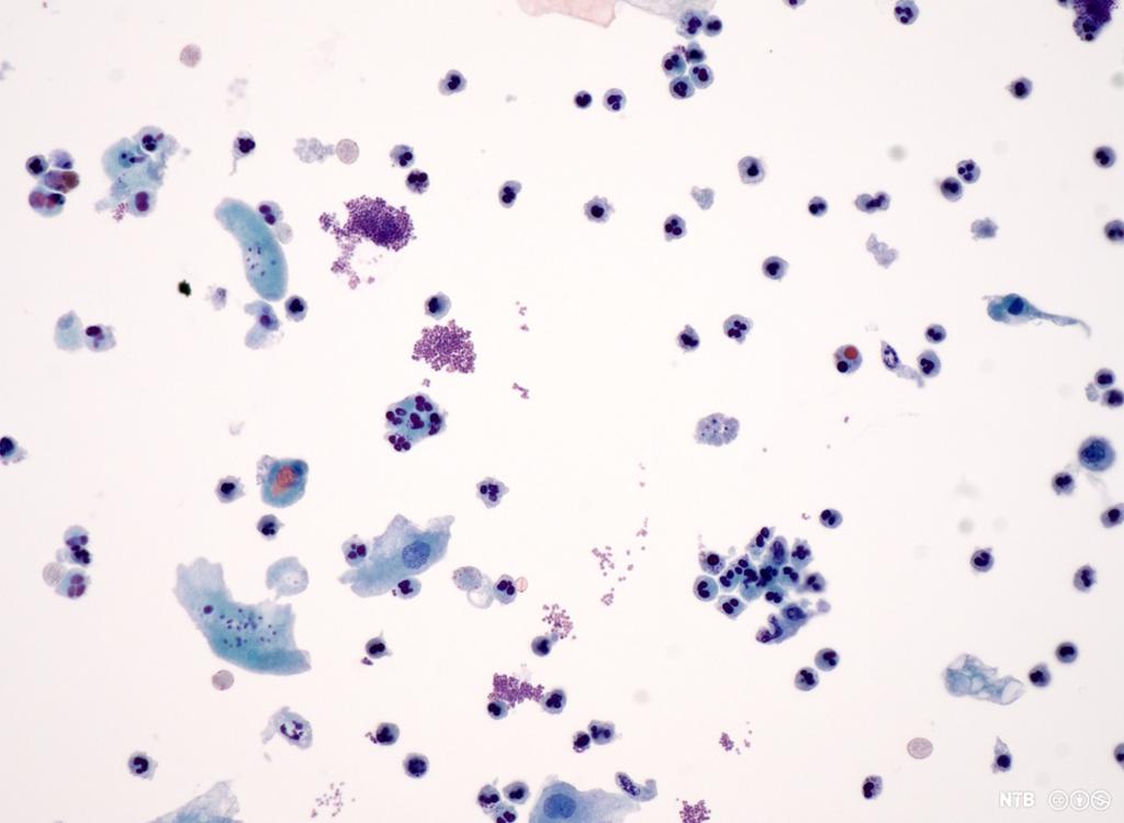 Celler der cellekjernen er synleg. Mikroskopfoto. 