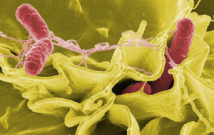 Salmonellabakterier på menneskeceller. Mikroskopfoto. 