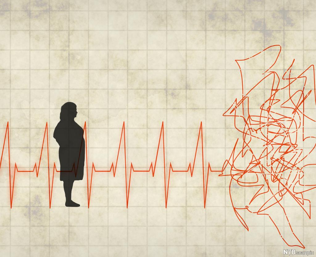 Silhuett av overvektig kvinne som står foran graf med hjertefrekvens. Illustrasjon.