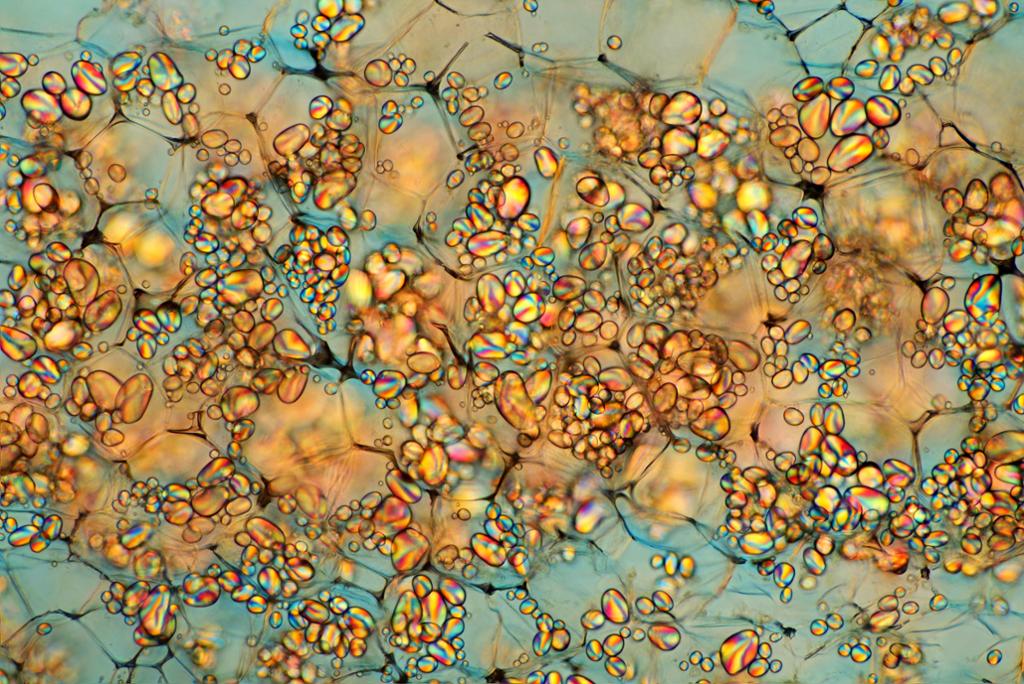 Mikroskopibilde av celleorganeller som inneholder små korn av stivelse som kan polarisere lys. Foto. 