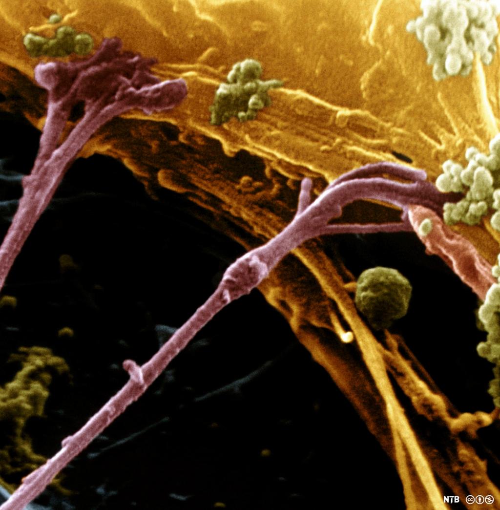 To nervetrådar dannar synapsar på overflata av ei nervecelle (dendritt). Fibrane forgreinar seg før dei dannar synapsane som ser ut som hevelsar på enden. Mikroskopfoto.