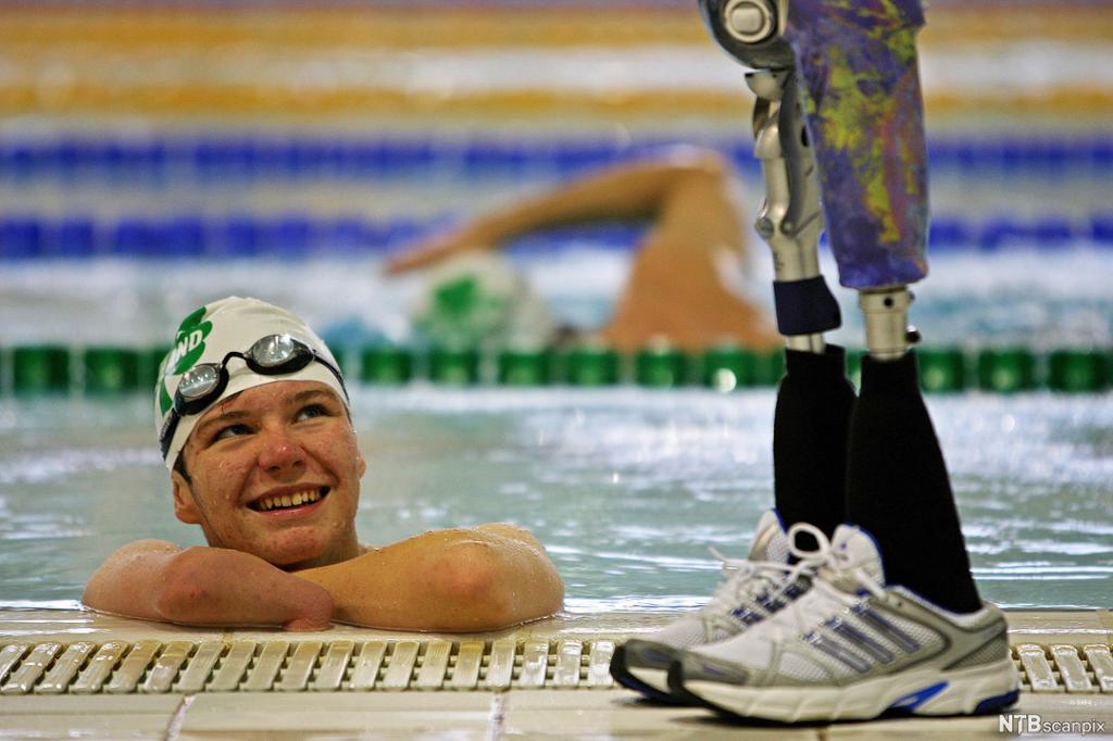 Paralympicssvømmer Darragh McDonald med sine benproteser. Foto. 
