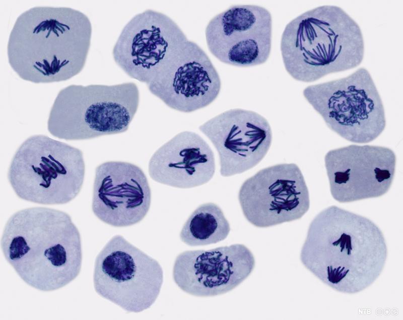 Celler som viser ulike stadier av celldeling. Foto. 