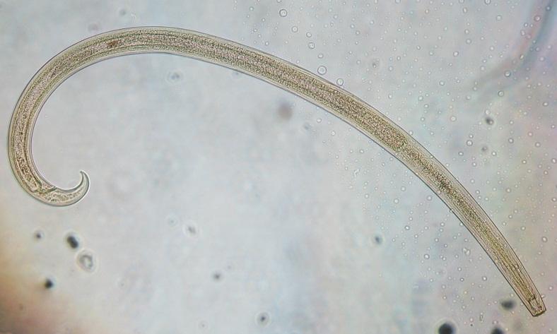 Mikroskopbilde av en gjennomsiktig orm med en spiss ende og en tverr ende. Foto.