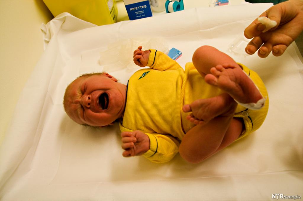 Baby i gul body som blir tatt blodprøve av. Foto.