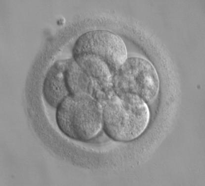 Bilde tatt gjennom mikroskop av et embryo på 8-cellestadiet. Foto.