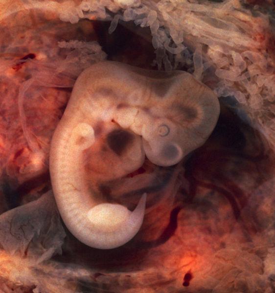 Et embryo med tydelig hode og spiss hale. Foto.