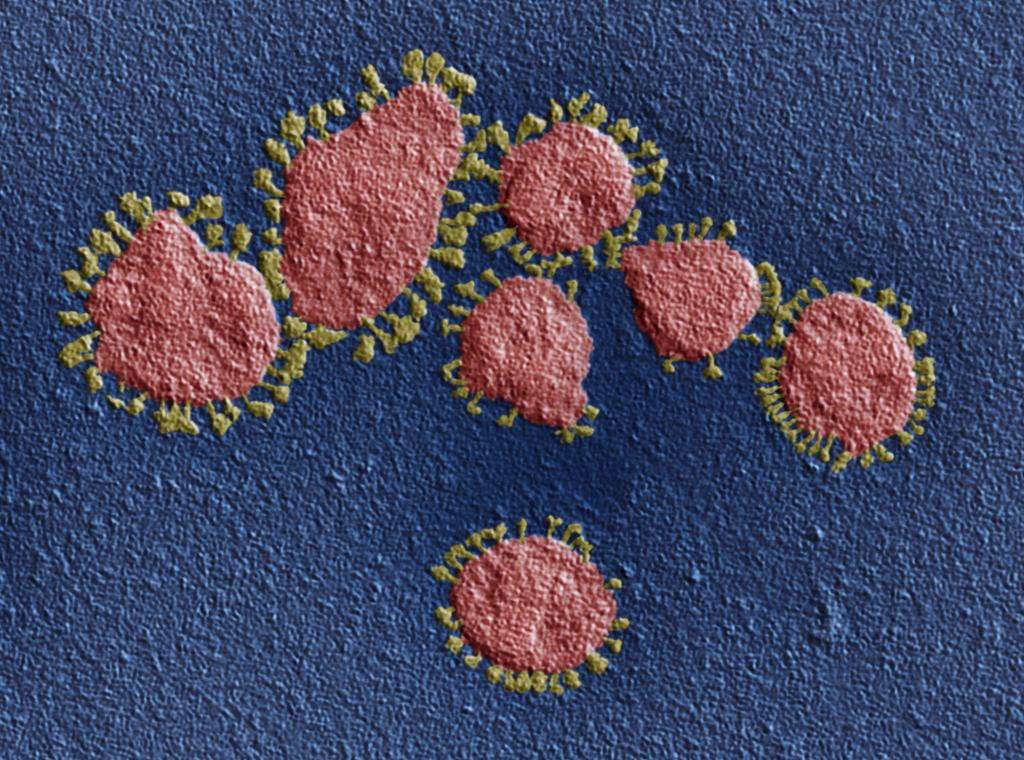 Virus farget røde med gule overflateproteiner. Foto.