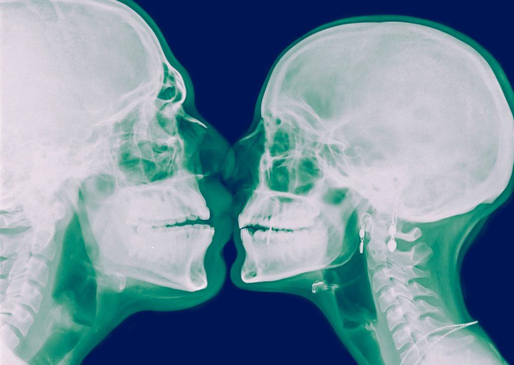 Røntgenbilete av to hovud som er vende mot kvarandre og kyssar. Foto.