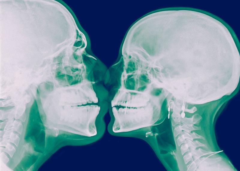 Røntgenbilde av to hoder som er vendt mot hverandre og kysser. Foto.
