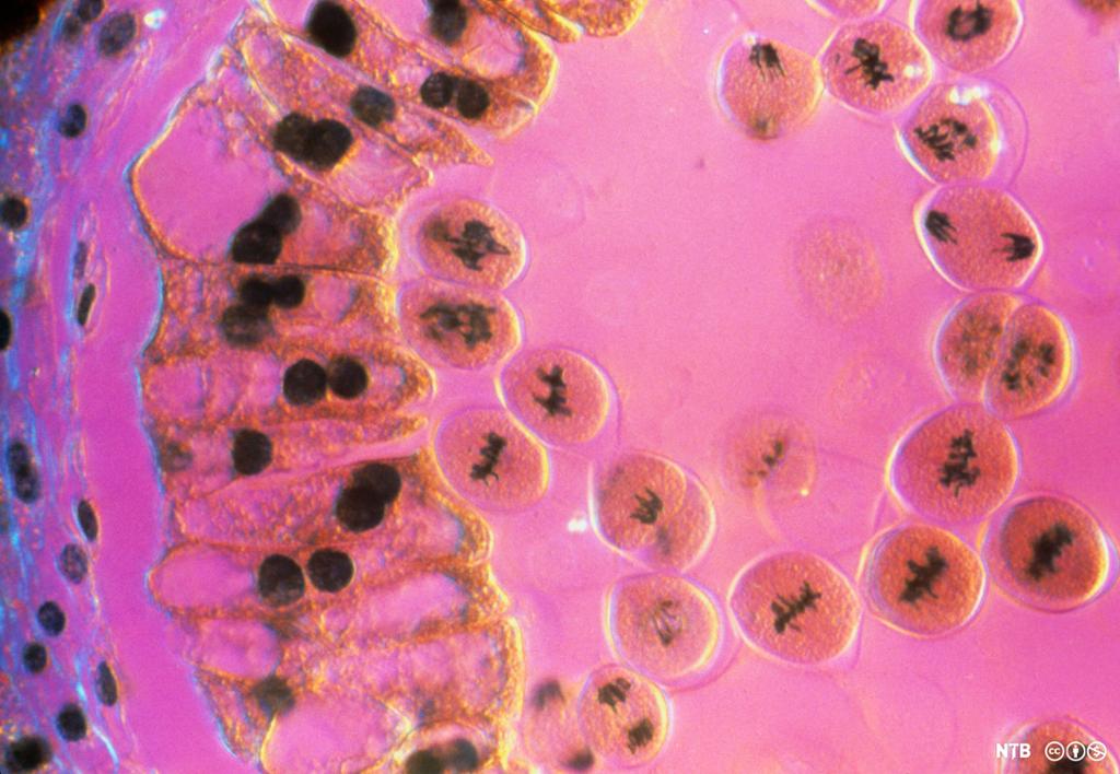 Celler i ulike stadier av celledeling ved meiose. Foto. 