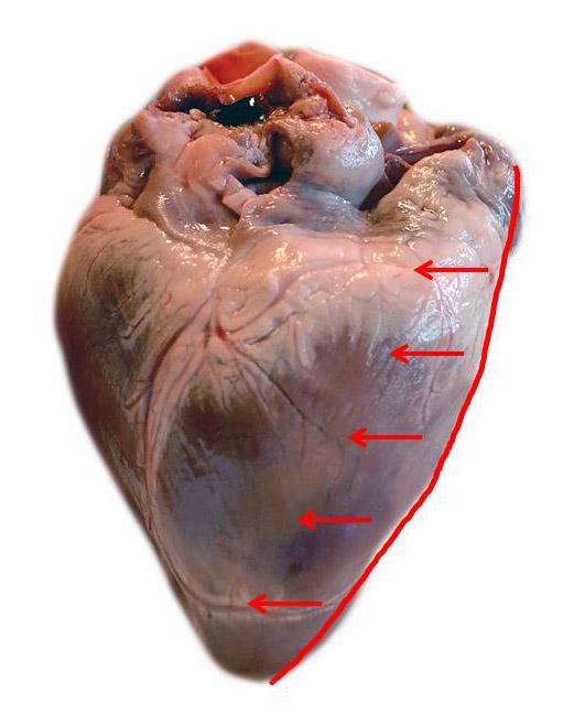 Bilde av et hjerte med piler viser hvor man skal snitte.