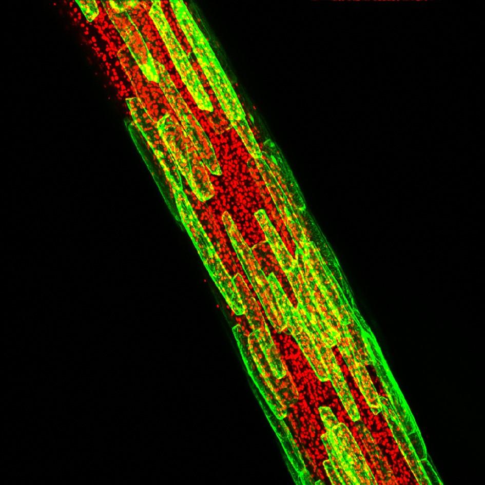 Plantestengel med tydelig avlange planteceller og små kloroplaster. Mikroskopfoto. 