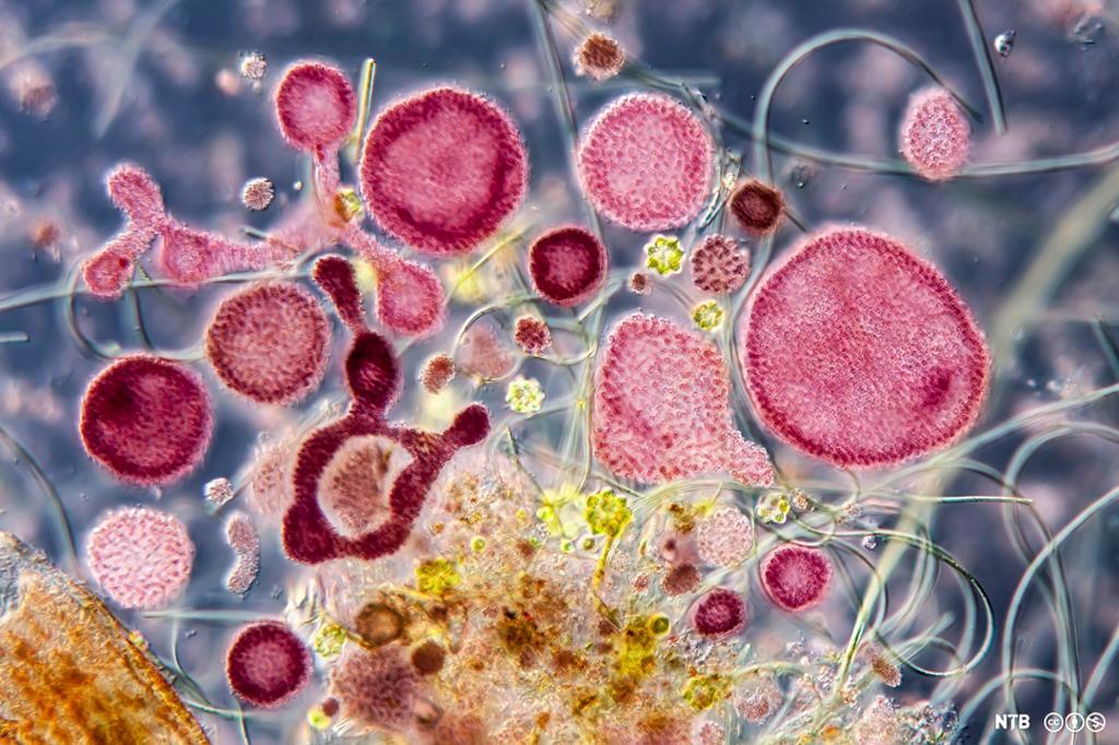 Bakteriar med ulike former og fasongar. Mikroskopfoto. 