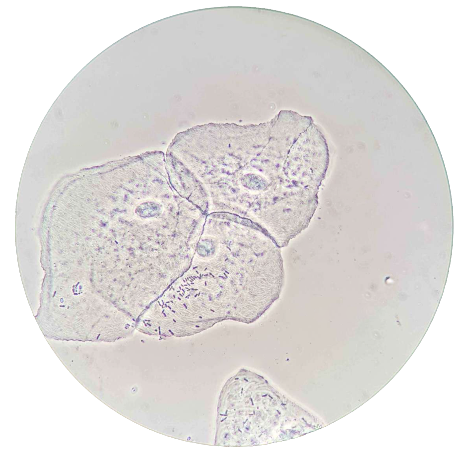 Epitelceller fra munnhulen til et menneske, sett gjennom mikroskop. Foto. 