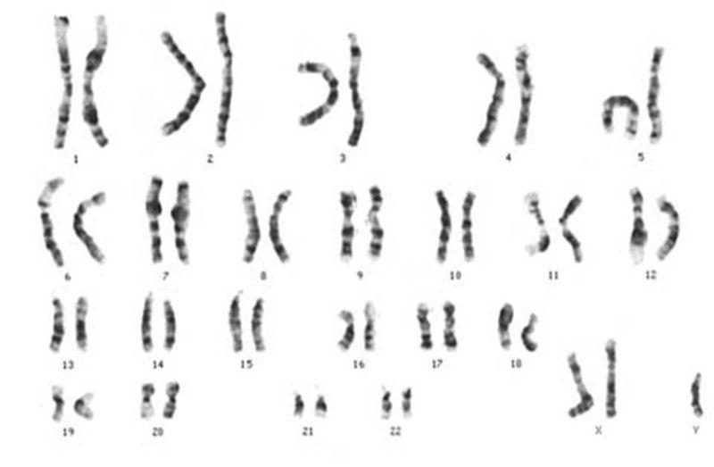 Koromosomer stilt opp parvis. Ett ekstra kjønnskromosom. Foto.