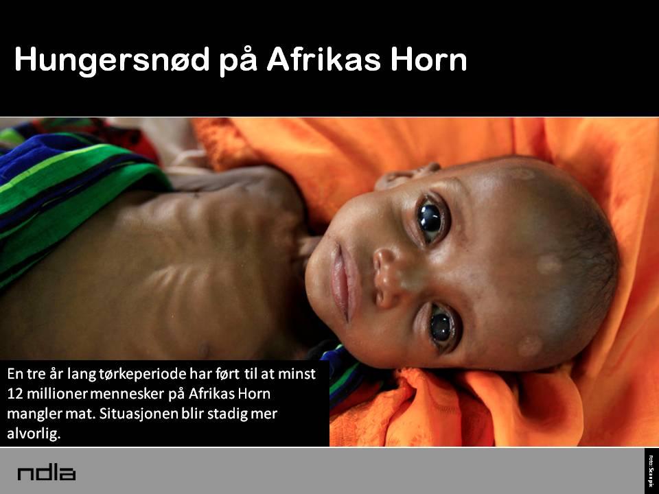 Et utsultet mørkhudet barn med store øyne. På tekstplakaten til venstre på bildet står det at 12 millioner mennesker på Afrikas Horn mangler mat. Foto.