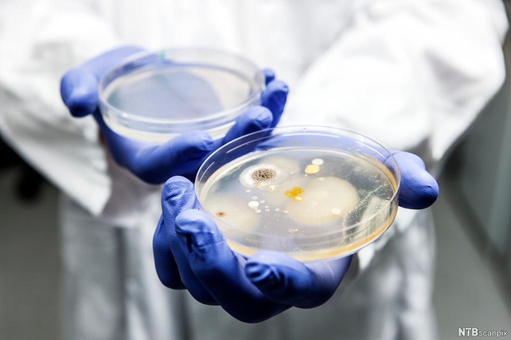 En forsker holder fram to petriskåler. Den ene petriskålen inneholder dyrkede mikroorganismer som bakterier og sopp, mens den andre petriskålen fungerer som en kontrollprøve. Foto.