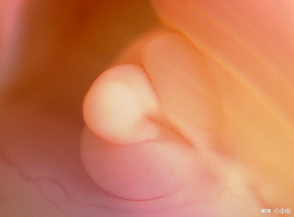 Foto av noe som kan utvikle seg til enten penis eller klitoris