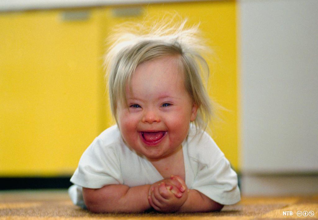Et smilende lite barn med typisk utseende for barn med Downs syndrom, blant annet skråstilte øyne og bred munn. Foto.