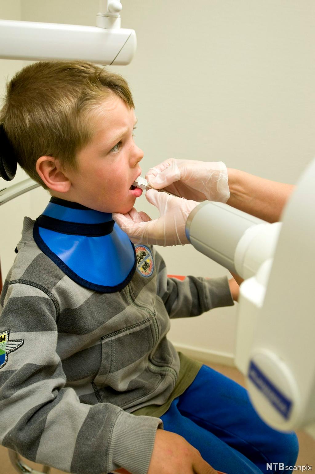 Eit barn tek røntgenbilete hos tannlegen. Foto.