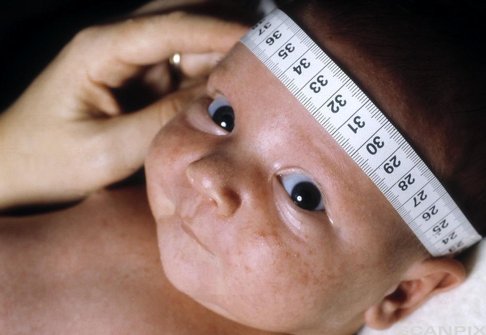 Bilde av en nyfødt baby som måles omkrets av hode på