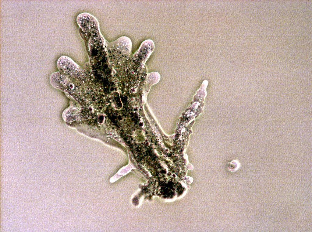 Mikroskopbilde av mikroorganisme som ser ut som en hånd med mange fingre. Foto.
