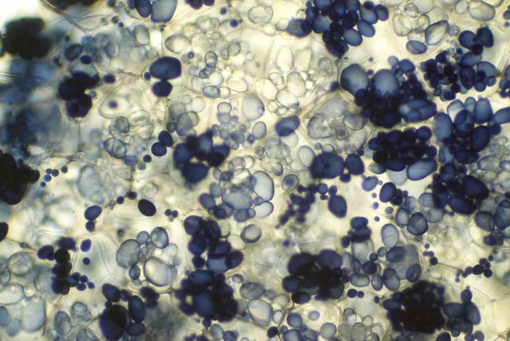 Mikroskopibilde av amyloplaster i tverrsnitt av en potet farget med kaliumjodidløsning. Foto.