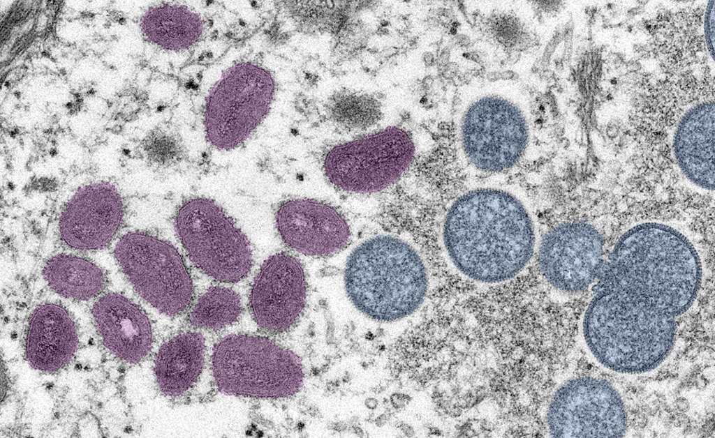 Ovale viruspartiklar med lilla farge og runde virus med blå farge. Foto.