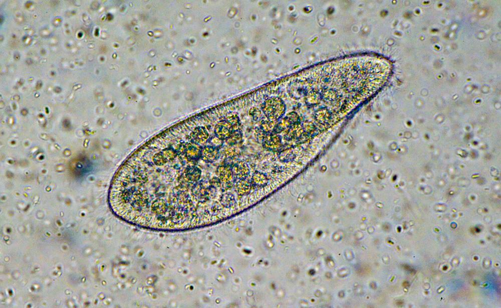 En stor avgrenset celle, et tøffeldyr, med flere indre sirkulære strukturer. Mikroskopfoto. 