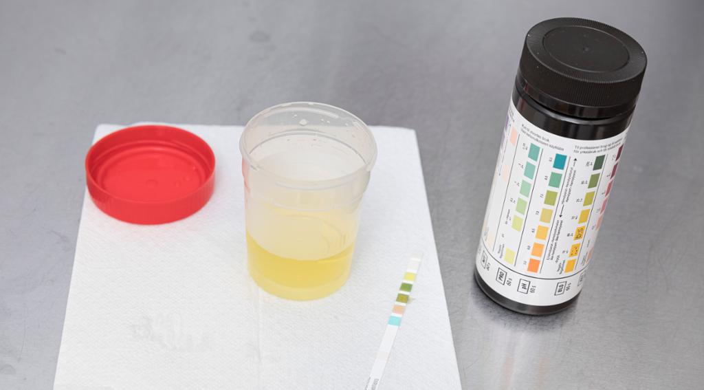 Urinprøveutstyr: et plastglass med lokk med urinprøve, en urinstix og urinstixbeholder med fargekoder for avlesing av prøven. Foto.