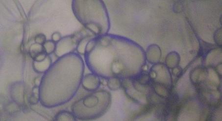 MIkroskopbilde av jodfargede stivelseskorn. Foto. 