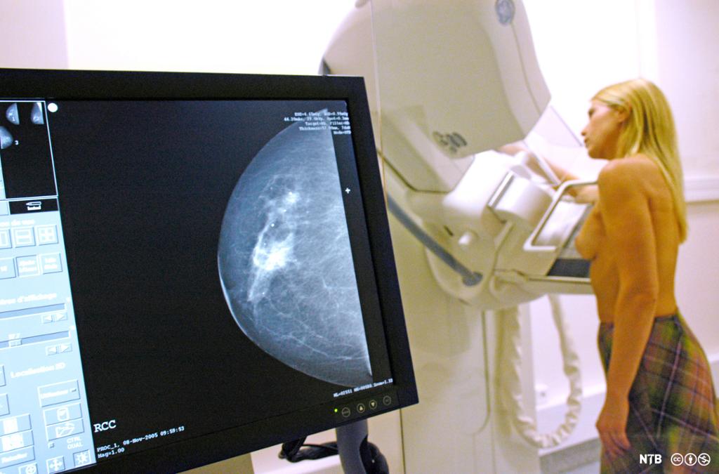 Røntgenbilde fra mammografiundersøkelse. Ung kvinne som undersøkes i bakgrunnen. Foto.