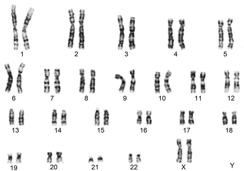 Nummererte kromosompar. Størrelsen varierer, men to og to er like. Mikroskopbilde.