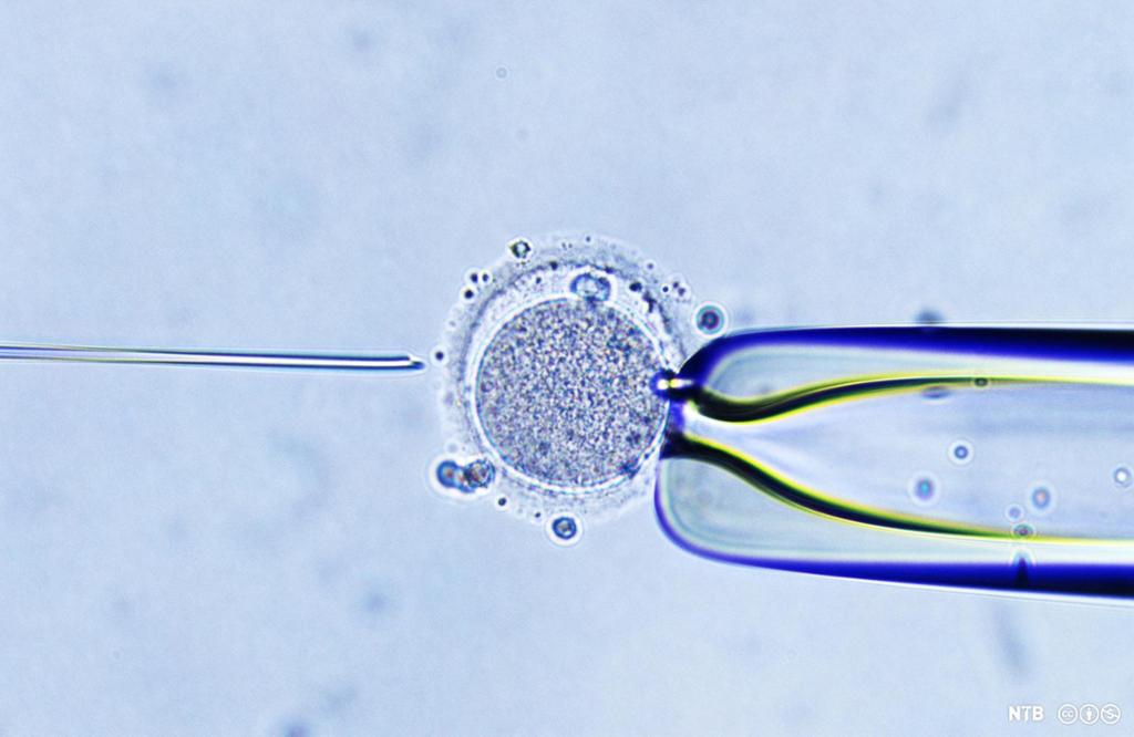 Med en tynn nål injiserer man en sædcelle i en eggcelle. Både nålen og cellene er fotografert gjennom mikroskop. Foto.