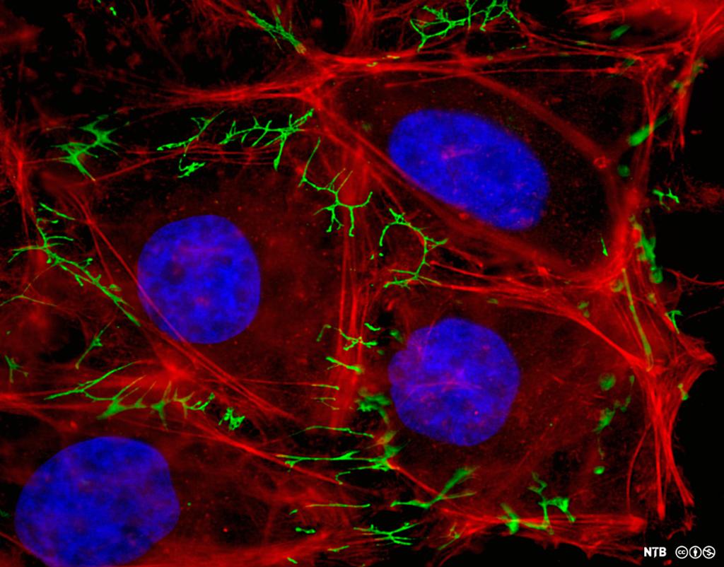 Fire nærliggende celler som er bundet sammen av trådformede proteiner i ekstracellulær matriks. Foto tatt gjennom fluorescensmikroskop. 
