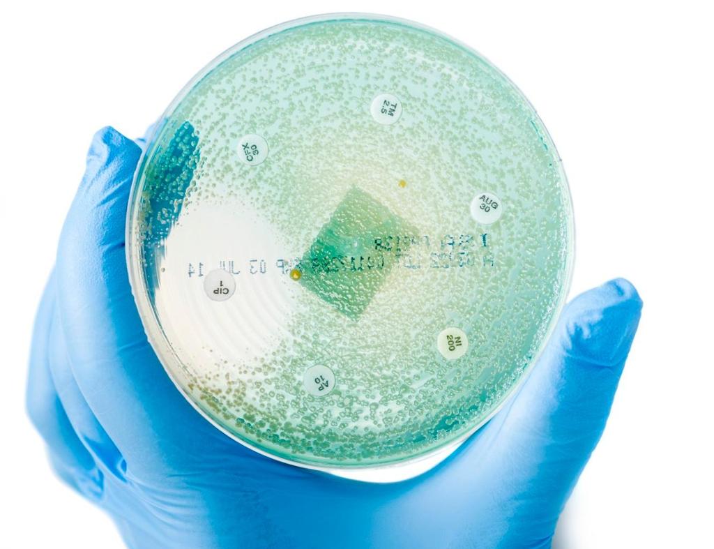 Ei hånd med blå hanske som holder en petriskål. Petriskålen inneholder dyrkede bakterier og antibiotikatabletter. Rundt den ene tabletten er det et felt uten bakterier. Foto.
