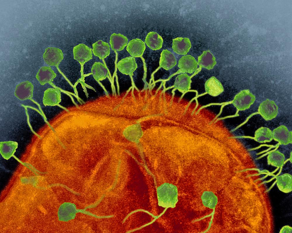 Elektronmikroskopbilde av virus som angriper bakterie. Foto.