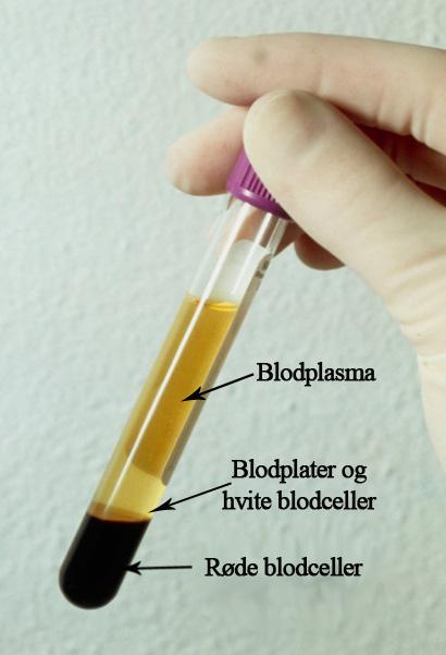 Sentrifugerør med innholdet delt i tre sjikt. Foto.