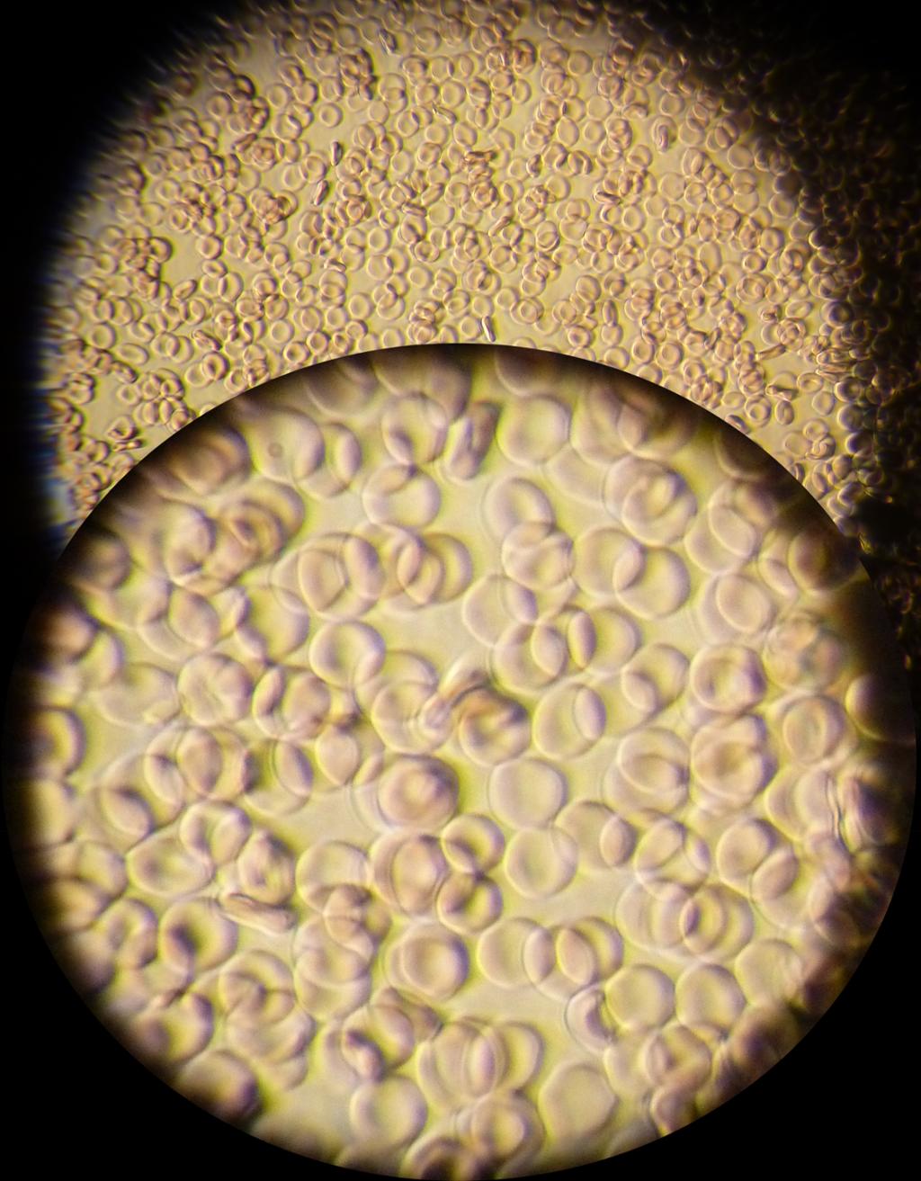 Foto av rødgule celler. De ser ut som baller med lite luft som er trykt flate på midten.