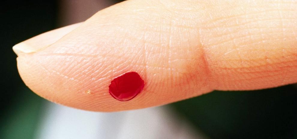 Foto av en finger med bloddråpe
