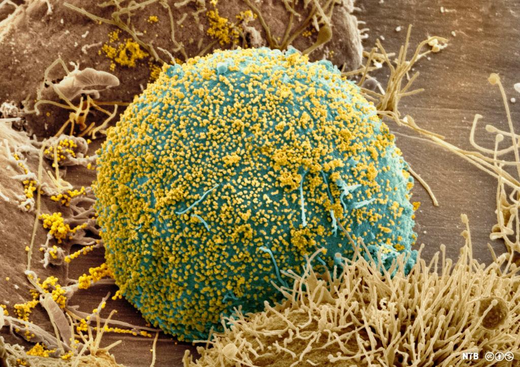 En stor, rund celle blir angrepet av hundrevis av små virus som sitter på celleoverflaten. Mikroskopfoto. 