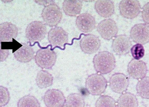 Spiralformet Borrelia-bakterie i blod. Mikroskopbilde.