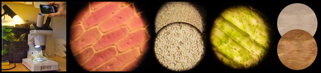 Mikroskopbilder av løkceller, blodceller, planteceller og muskelceller. Foto.