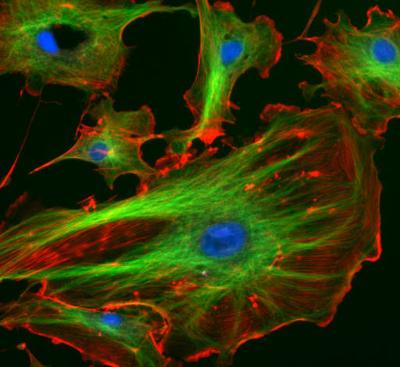 Fluorecsent celle hvor cytoskjelettet vises tydelig.